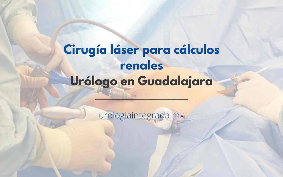 articulo sobre calculos renales cirugía. Urología Guadalajara