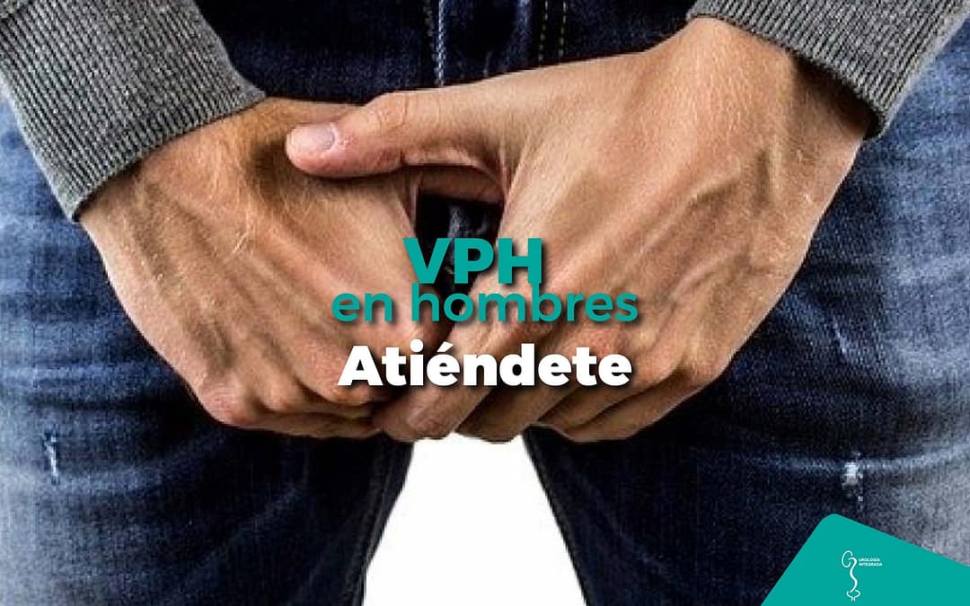 VPH virus papiloma humano Guadalajara