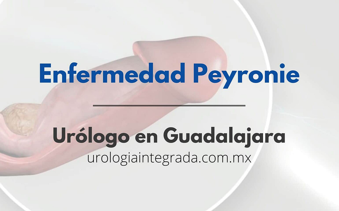 Urólogo Guadalajara